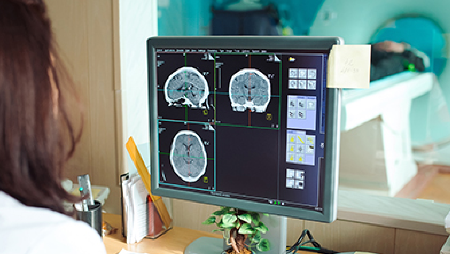 CT Scan in Bhopal at Chandan Diagnostic Centre
