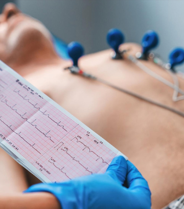 ECG Test in Bhopal