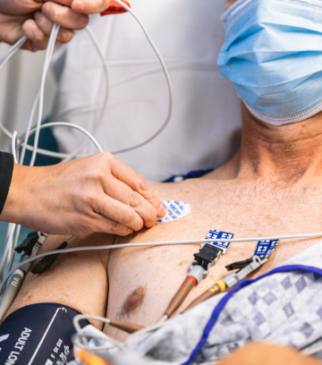 ECG Test in Varanasi