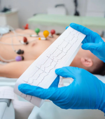 ECG Test in Jaipur