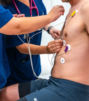 ECG Test in Lucknow