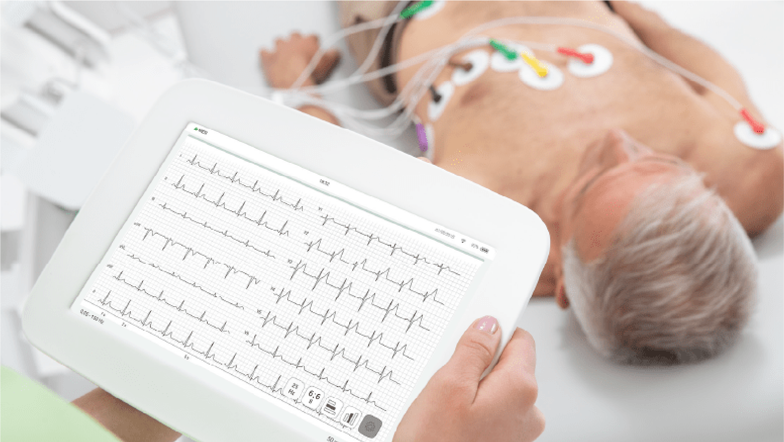 ECG Test in Gorakhpur at Chandan Diagnostic Centre