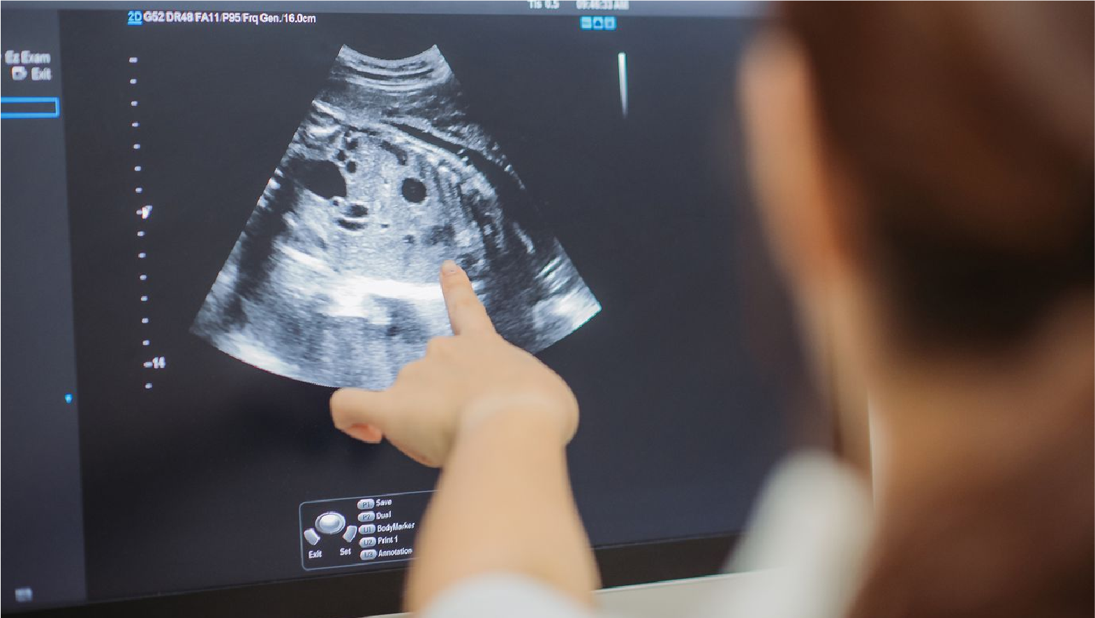 Best X-Ray in Raipur