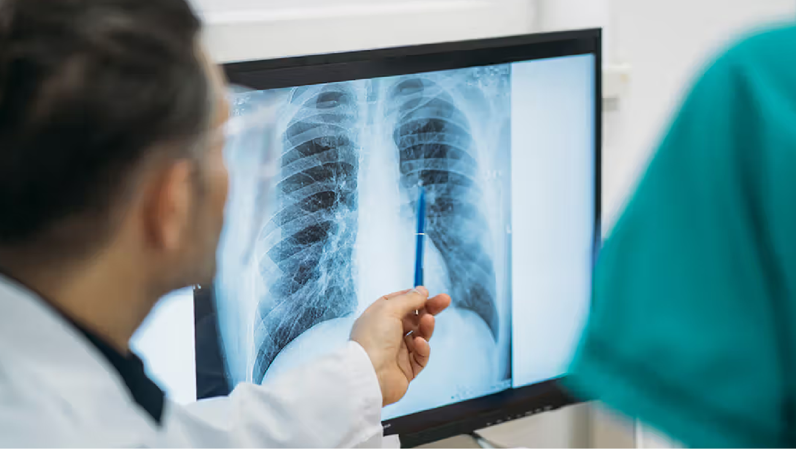 Digital X-Ray Test in Varanasi at Chandan Diagnostic Centre