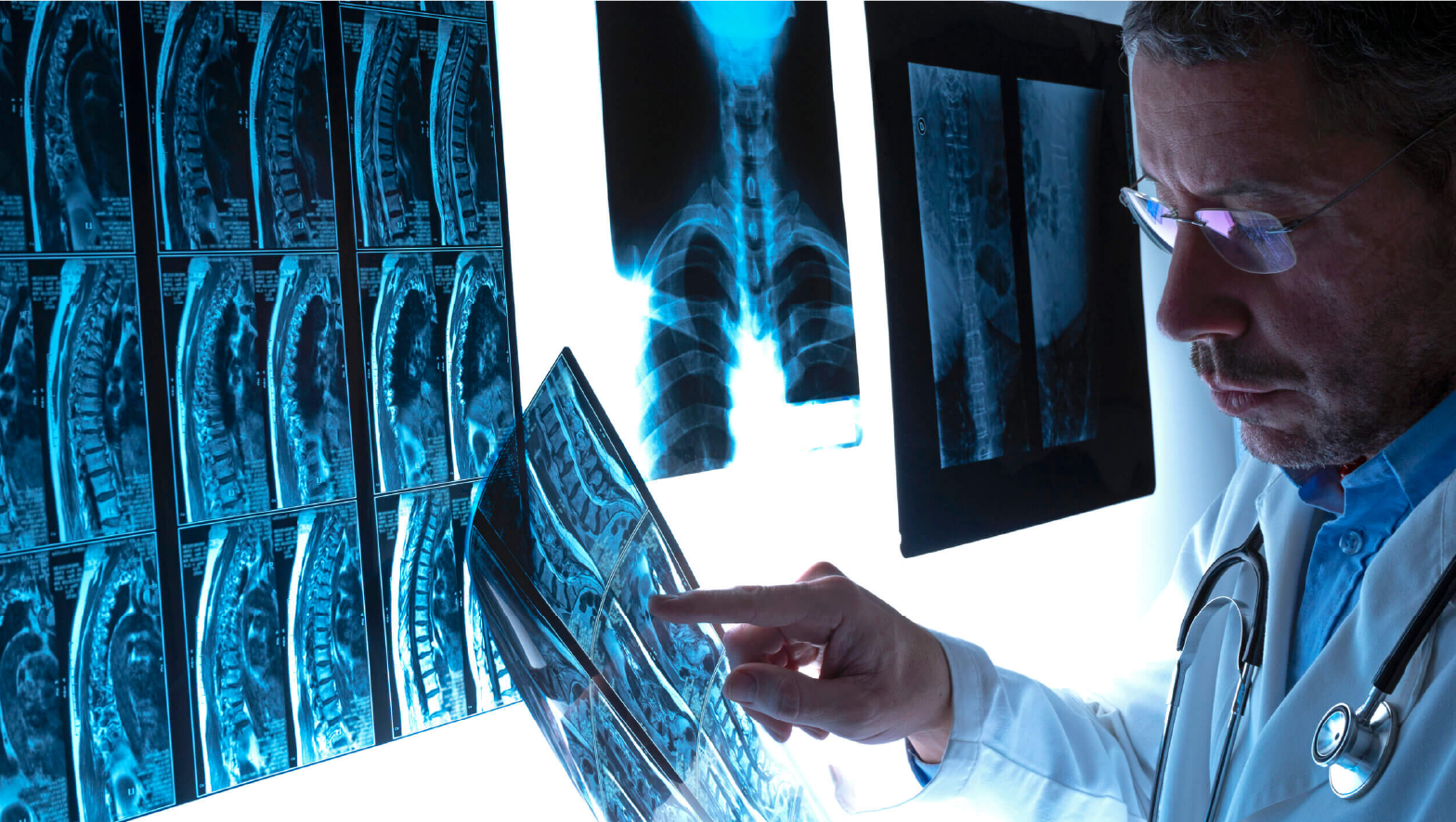 Digital X-Ray Test in Dehradun at Chandan Diagnostic Centre