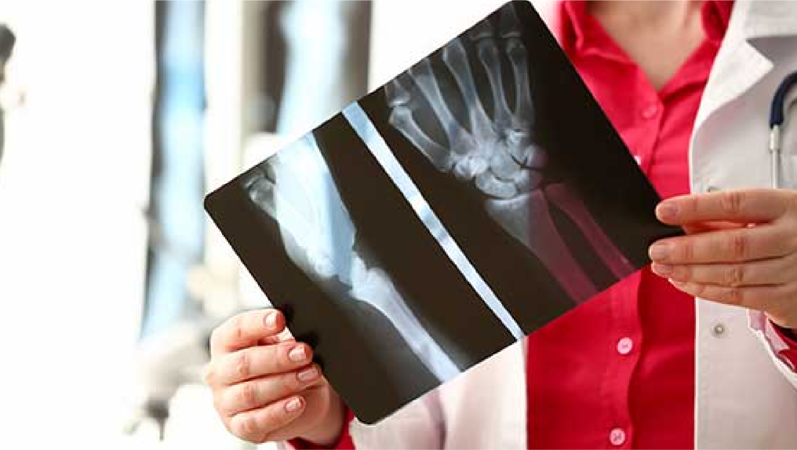 Digital X-Ray Test in Gorakhpur at Chandan Diagnostic Centre