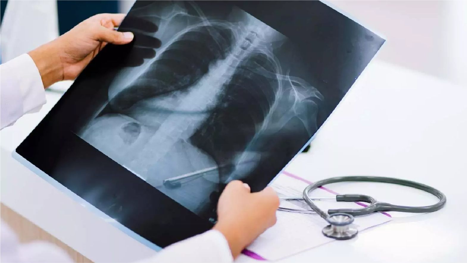Digital X-Ray Test in New Delhi at Chandan Diagnostic Centre