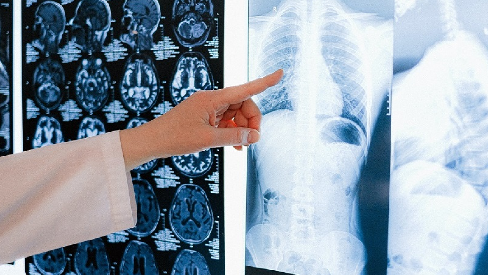 Digital X-Ray Test in Raipur at Chandan Diagnostic Centre