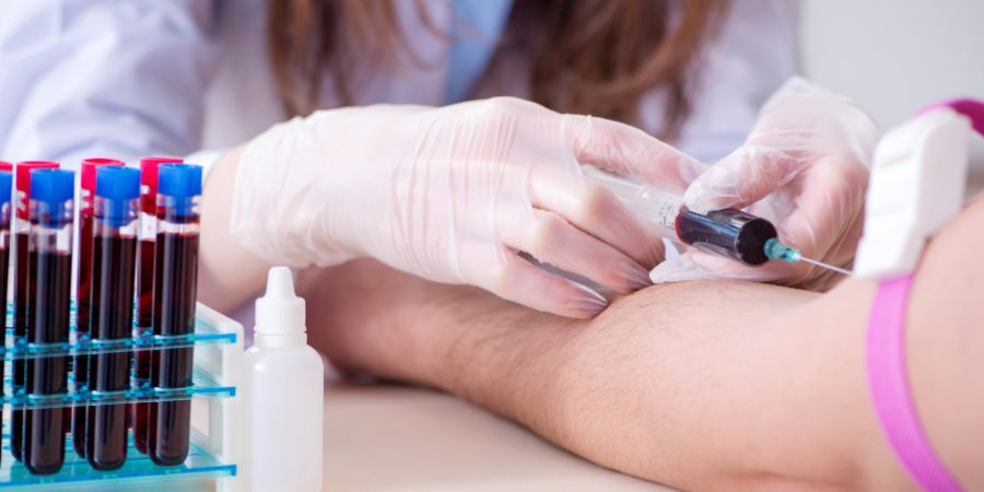 MCV Blood Test