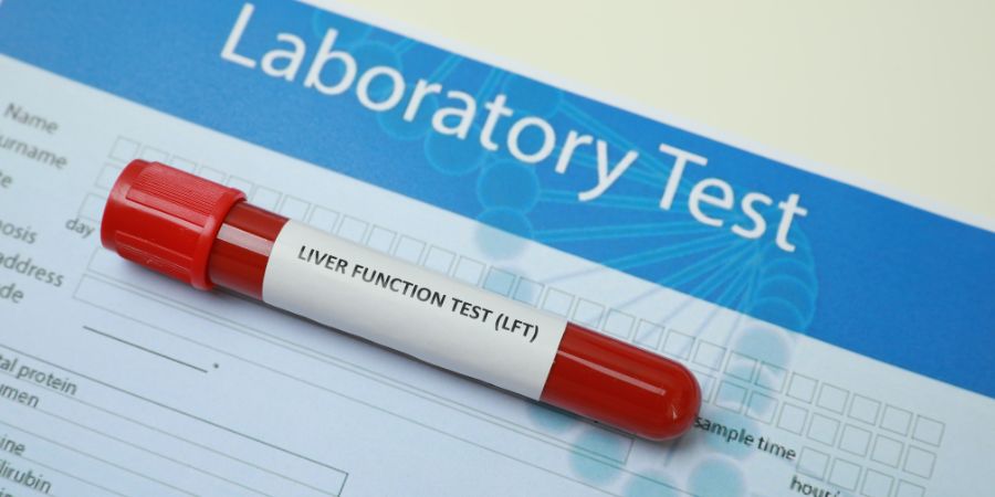 Liver Function Blood Test
